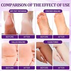 24 PCS Foot Soak, Pedicure Kit Foot Soak Set - Image 3