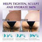 Anti Cellulite Massage Oil for Massage Therapy - Image 5