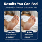 Imperial Feet Epsom Salt Foot Soak-Relaxing Wellness Detox Foot Soak - Image 6