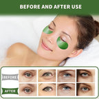 Qyiywim Under Eye Patches 70PCS, Under Eye Masks - Image 6