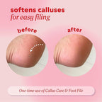 Onyx Professional Callus and Corn Peeling Gel, 4 fl oz - Image 4