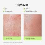 MAREE Exfoliating Toner with Salicylic Acid – AHA BHA Face Exfoliant & Pore - Image 5