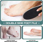 Lothee 30 Pack Foot File Foot Callus Remover Double Sided Professional - Image 5