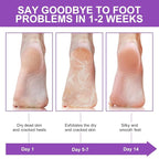 Foot Peeling Mask 5 Pack, Foot Peel Mask Remove Dead Skin, Rough Callus and - Image 6