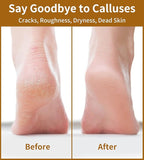 Nano Glass Foot File, Double-Sided Foot Callus Remover Feet Scrubber Hard & - Image 6