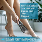 Callus Remover for Feet - Image 6