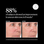 Naturium Vitamin C Super Serum Plus, Smoothing Face Care, plus Retinol - Image 5