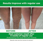 TESMED Cellulite Manual Massager : Made in Italy, Patented - Image 4