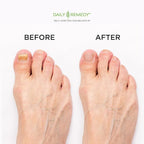 DAILY REMEDY EXTRA STRENGTH Tea Tree Oil Foot Soak w/ Epsom Salt Made in USA - Image 4