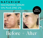 Naturium Niacinamide Face Serum 12% Plus Zinc 2%, Anti-Aging, Pore Minimizer & - Image 5