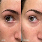 Topicals Faded Brightening Under Eye Masks | Patches to Depuff, Brighten and - Image 5