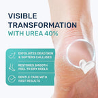 Urea Cream 40 Percent for Feet Maximum Strength - Image 2