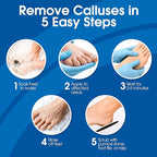 DeEnti Callus Remover for Feet, Extra Strength Foot Callus Remover Gel - Image 4