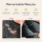 Jupiter Scalp Exfoliator - Image 3