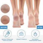 ForPro Professional Collection Premium Callus No More! Callus Remover, - Image 5