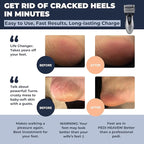 Electric Callus Remover: Rechargeable Electronic Foot File CR900 by Own Harmony - Image 2