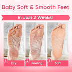 Foot Peel Mask - Foot Mask for Baby Soft Skin - Remove Dead Skin, Cracked Feet - Image 4