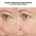 Olay Pro-X Dermatological Even Skin Tone Spot Fading Treatment Serum, 1.3 oz - Image 4