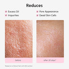 MAREE Pore Minimizer for Face Toner – Witch Hazel Toner - Image 5