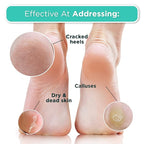 DERMORA Foot Peel Mask | Skin Exfoliating Foot Masks - Image 5