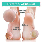DERMORA Foot Peel Mask | Skin Exfoliating Foot Masks - Image 4