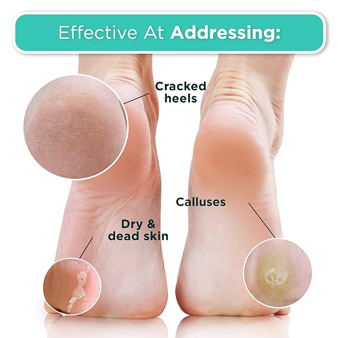 DERMORA Foot Peel Mask | Skin Exfoliating Foot Masks - Image 4