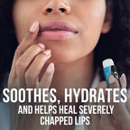 Chapstick ChapStick Classic Lip Balm Skin Protectant Bulk, Medicated Flavor - Image 2