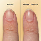 Sally Hansen Vitamin E Nail & Cuticle Treatment Pen | Hydrates and Conditions - Image 5