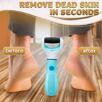 Electric Foot Sander Callus Remover – 3-Speed Foot Sanders - Image 5