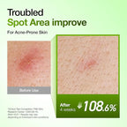 Anua Azelaic Acid 10 Hyaluron Redness Soothing Serum, Facial Serum - Image 4