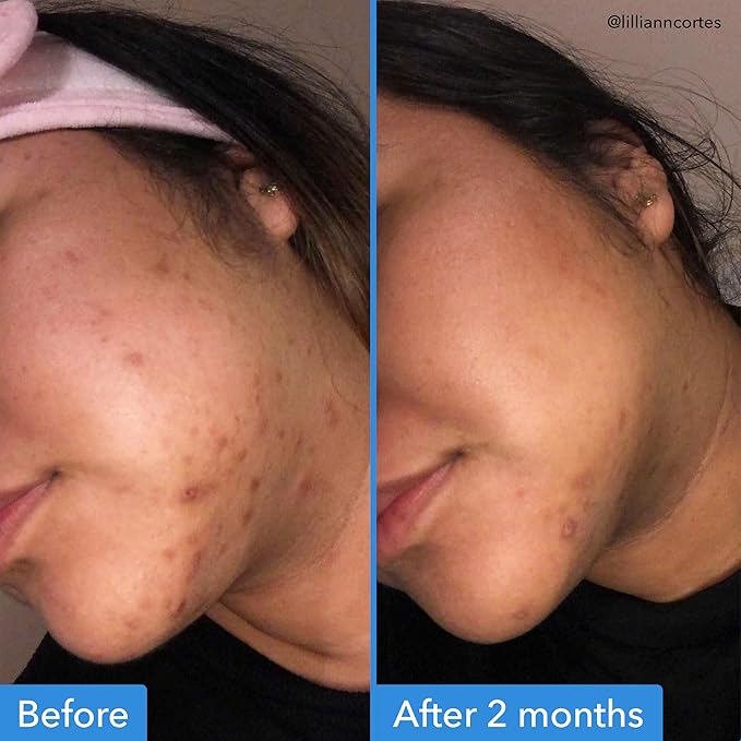Good Molecules Discoloration Correcting Serum - Image 3