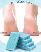 Maryton Disposable Foot Scrubber Pumice Pads, Pedicure Pumice Stone Dead Skin - Image 4