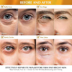 Enaskin Naturals Under Eye Patches - Image 3