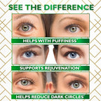 Under Eye Mask for Puffy Eyes, Dark Circles, Eye Bags, Wrinkles - Image 5