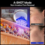 INIA SPHERA Upgraded 8-in-1 Microcurrent Facial Device - Image 8