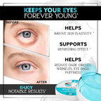 Under Eye Patches for Puffy Eyes, Dark Circles, Dull Skin - Image 2