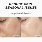 8pcs Collagen Face Mask, Hydrogel Overnight Face Mask - Image 5