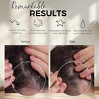 Fiora Naturals Scalp Massager Shampoo Brush - Image 2
