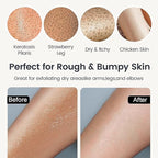 Yiclick Heavy Exfoliating Gloves 4Pcs, Exfoliating Mitts, Body Scrubber - Image 5