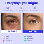 Eye Serenity Steam Eye Mask, Heated Eye Mask, Self Heating Warm Compress - Image 4